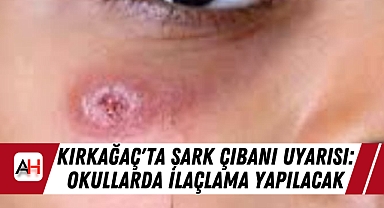 Kırkağaç'ta Şark Çıbanı Uyarısı: Okullarda İlaçlama Yapılacak